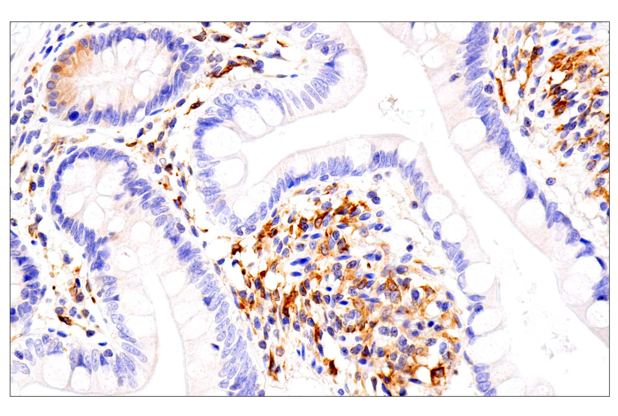 Immunohistochemistry Image 5: HLA-E (MEM-E/02) Mouse mAb