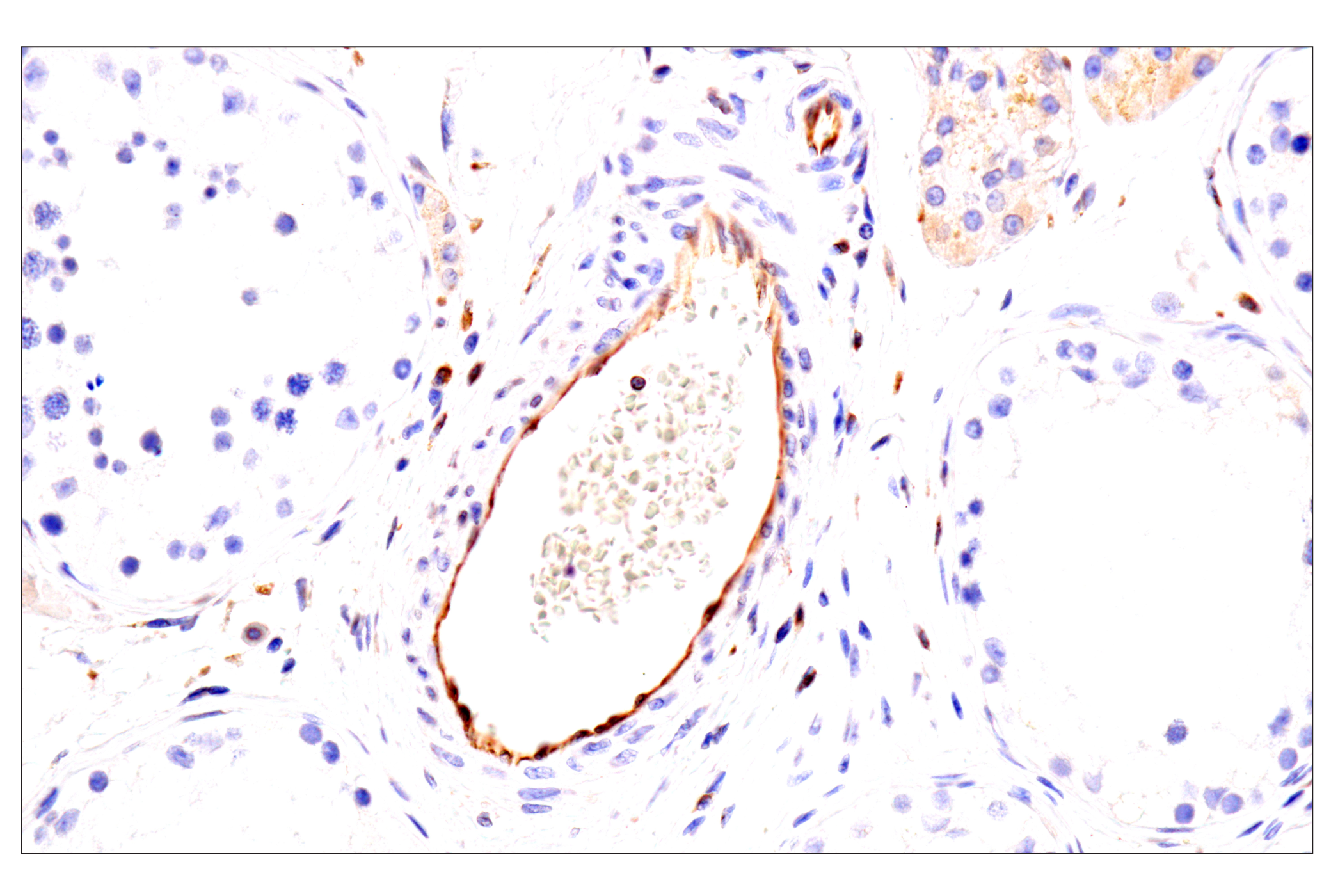 Immunohistochemistry Image 4: HLA-E (MEM-E/02) Mouse mAb