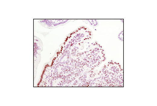 Immunohistochemistry Image 3: Phospho-Stat3 (Tyr705) (D3A7) XP® Rabbit mAb (BSA and Azide Free)