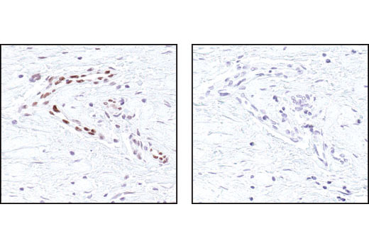 Immunohistochemistry Image 5: Phospho-Stat3 (Tyr705) (D3A7) XP® Rabbit mAb (BSA and Azide Free)