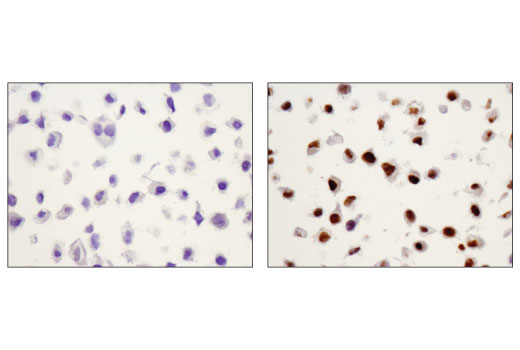 Immunohistochemistry Image 4: Phospho-Stat3 (Tyr705) (D3A7) XP® Rabbit mAb (BSA and Azide Free)