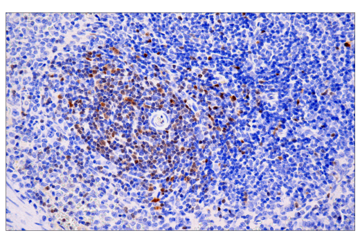  Image 79: Human Exhausted CD8+ T Cell IHC Antibody Sampler Kit