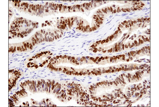 Immunohistochemistry Image 5: Sox9 (D8G8H) Rabbit mAb (BSA and Azide Free)