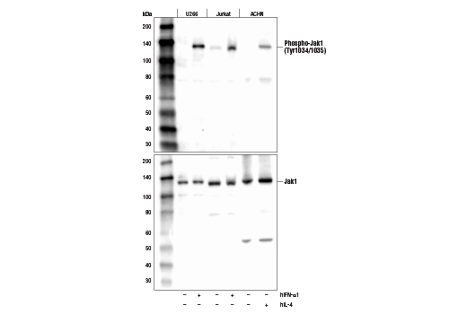  Image 13: IFN (Type I/III) Signaling Pathway Antibody Sampler Kit