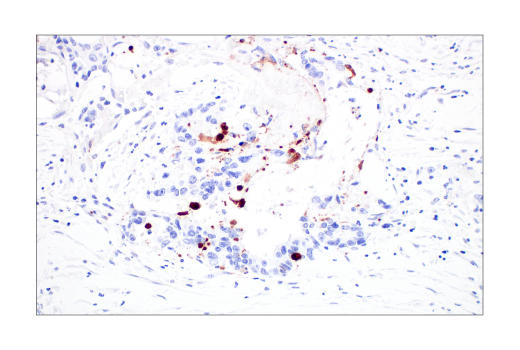 Immunohistochemistry Image 5: Cleaved Caspase-3 (Asp175) (D3E9) Rabbit mAb (BSA and Azide Free)