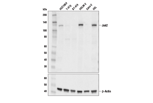 Western Blotting Image 1: Jak2 (E4Y4D) Mouse mAb