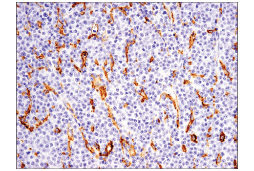  Image 7: Suppressive Myeloid Cell Phenotyping IHC Antibody Sampler Kit