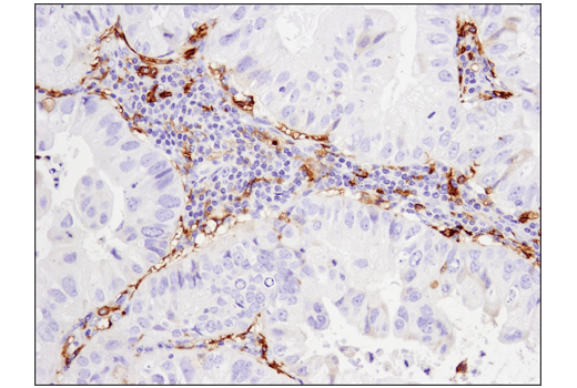  Image 25: Suppressive Myeloid Cell Phenotyping IHC Antibody Sampler Kit