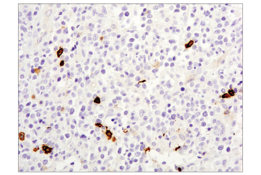 Immunohistochemistry Image 1: OX40 (E9U7O) XP® Rabbit mAb (BSA and Azide Free)