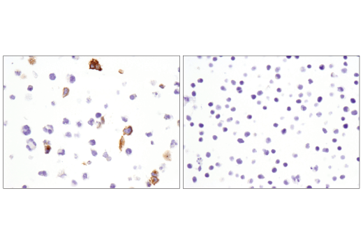 Immunohistochemistry Image 7: OX40 (E9U7O) XP® Rabbit mAb (BSA and Azide Free)