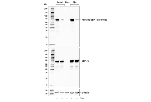 Western Blotting Image 1: Phospho-SLP-76 (Ser376) (E3G9U) XP® Rabbit mAb