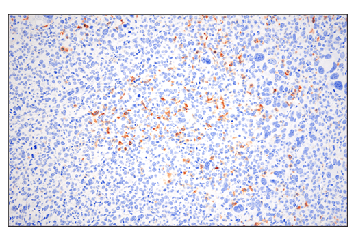 Immunohistochemistry Image 1: Phospho-SLP-76 (Ser376) (E3G9U) XP® Rabbit mAb