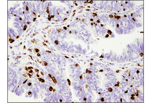  Image 13: Human Reactive M1 vs M2 Macrophage IHC Antibody Sampler Kit