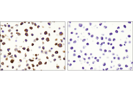  Image 46: Human Reactive M1 vs M2 Macrophage IHC Antibody Sampler Kit