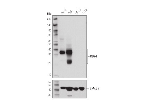 Western Blotting Image 1: CD74 (D5N3I) XP® Rabbit mAb