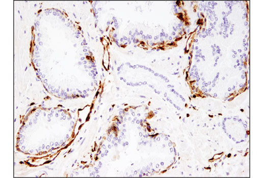 Immunohistochemistry Image 2: CD74 (D5N3I) XP® Rabbit mAb