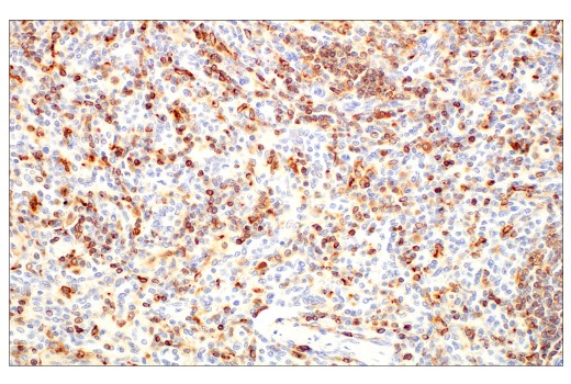 Immunohistochemistry Image 4: CD74 (D5N3I) XP® Rabbit mAb