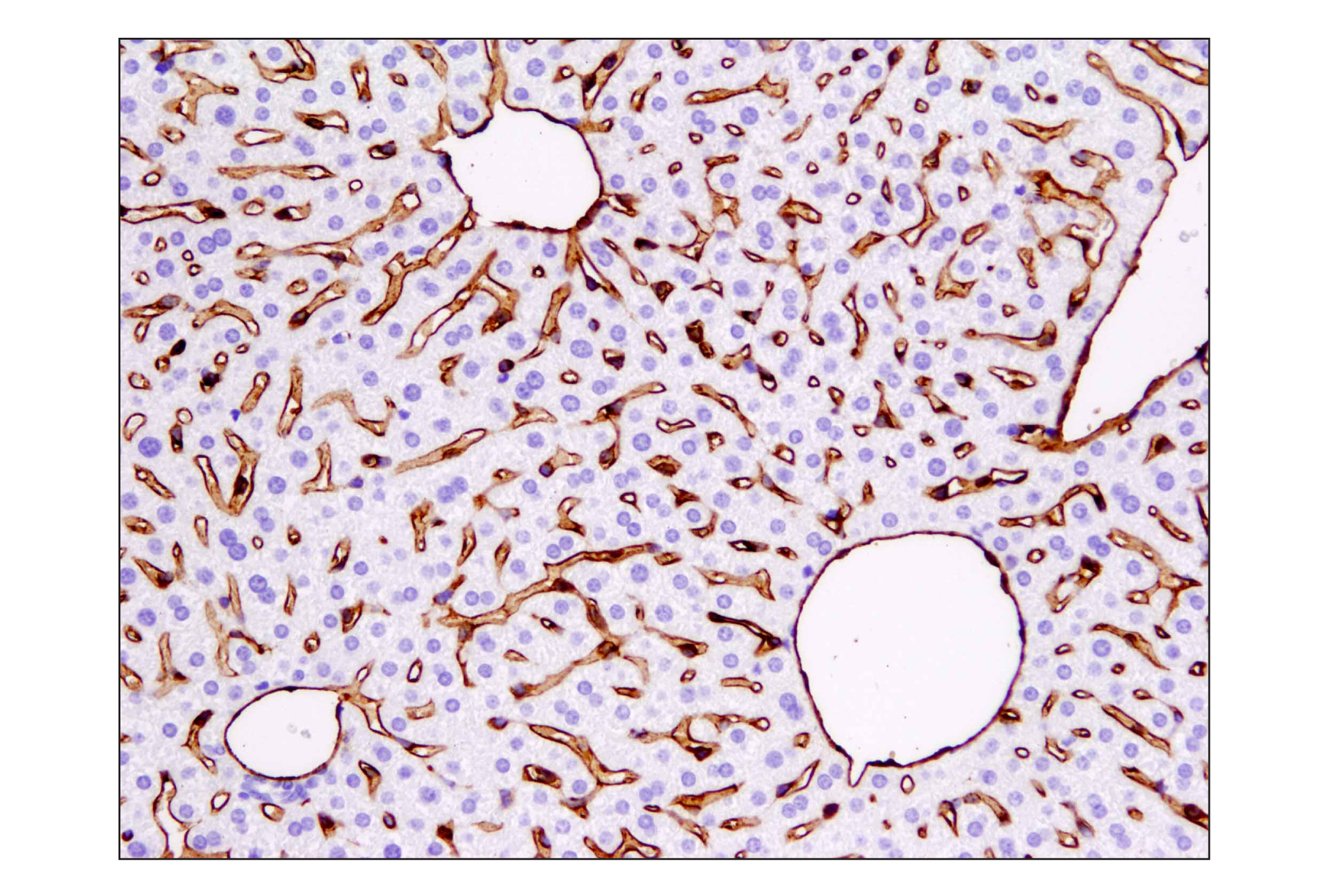 Immunohistochemistry Image 3: CD31 (PECAM-1) (D8V9E) XP® Rabbit mAb