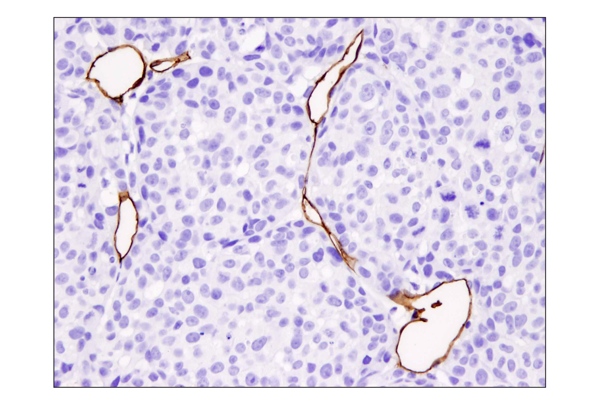 Immunohistochemistry Image 4: CD31 (PECAM-1) (D8V9E) XP® Rabbit mAb