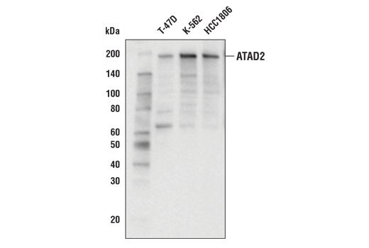 Western Blotting Image 1: ATAD2 (E8Y2K) Rabbit mAb