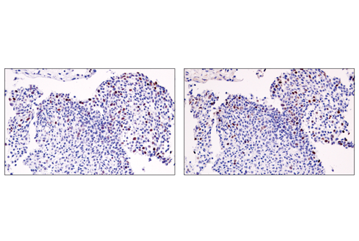 Immunohistochemistry Image 1: ATAD2 (E8Y2K) Rabbit mAb