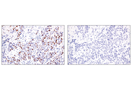 Immunohistochemistry Image 2: ATAD2 (E8Y2K) Rabbit mAb