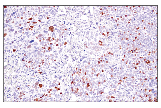 Immunohistochemistry Image 4: ATAD2 (E8Y2K) Rabbit mAb