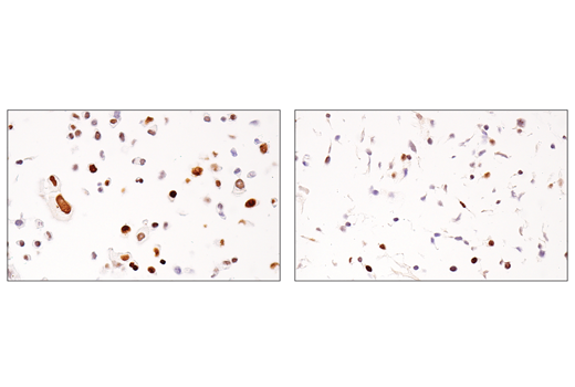 Immunohistochemistry Image 5: ATAD2 (E8Y2K) Rabbit mAb