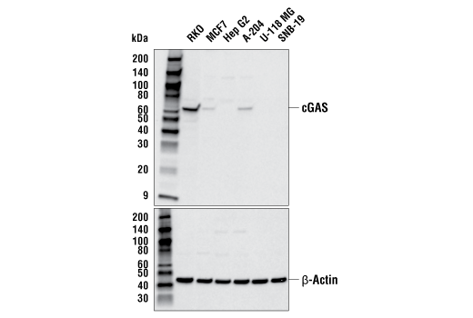 Western Blotting Image 2: cGAS (E5V3W) Rabbit mAb