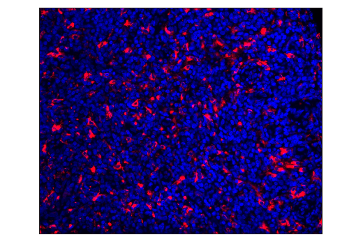 Immunohistochemistry Image 1: CD68 (D4B9C) XP® Rabbit mAb (Alexa Fluor® 647 Conjugate)