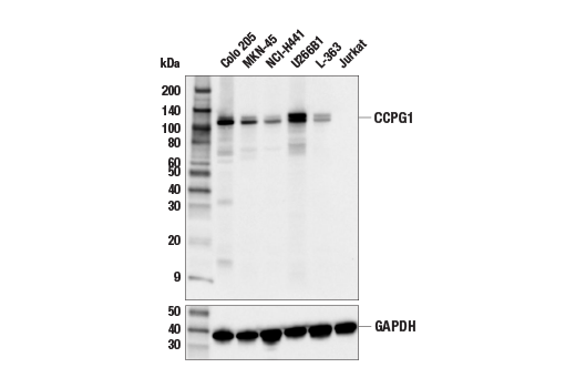  Image 11: ER Homeostasis Antibody Sampler Kit