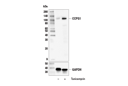  Image 12: ER Homeostasis Antibody Sampler Kit