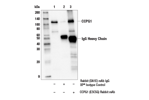  Image 14: ER Homeostasis Antibody Sampler Kit