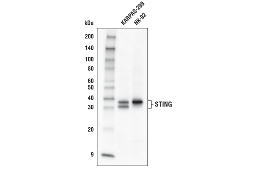 Western Blotting Image 1: STING (D2P2F) Rabbit mAb (Biotinylated)