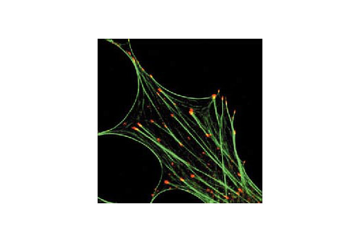 Immunofluorescence Image 2: Phospho-Tyrosine Mouse mAb (P-Tyr-100) (BSA and Azide Free)