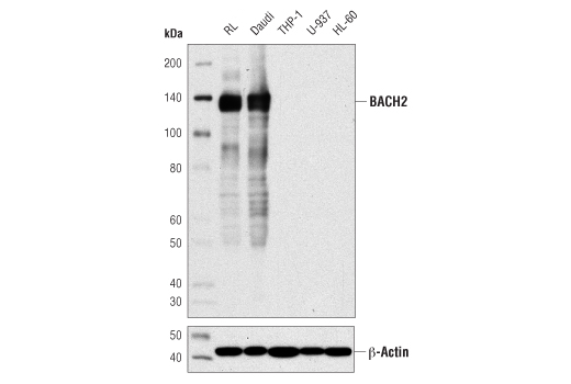 Western Blotting Image 1: BACH2 (D3T3G) Rabbit mAb