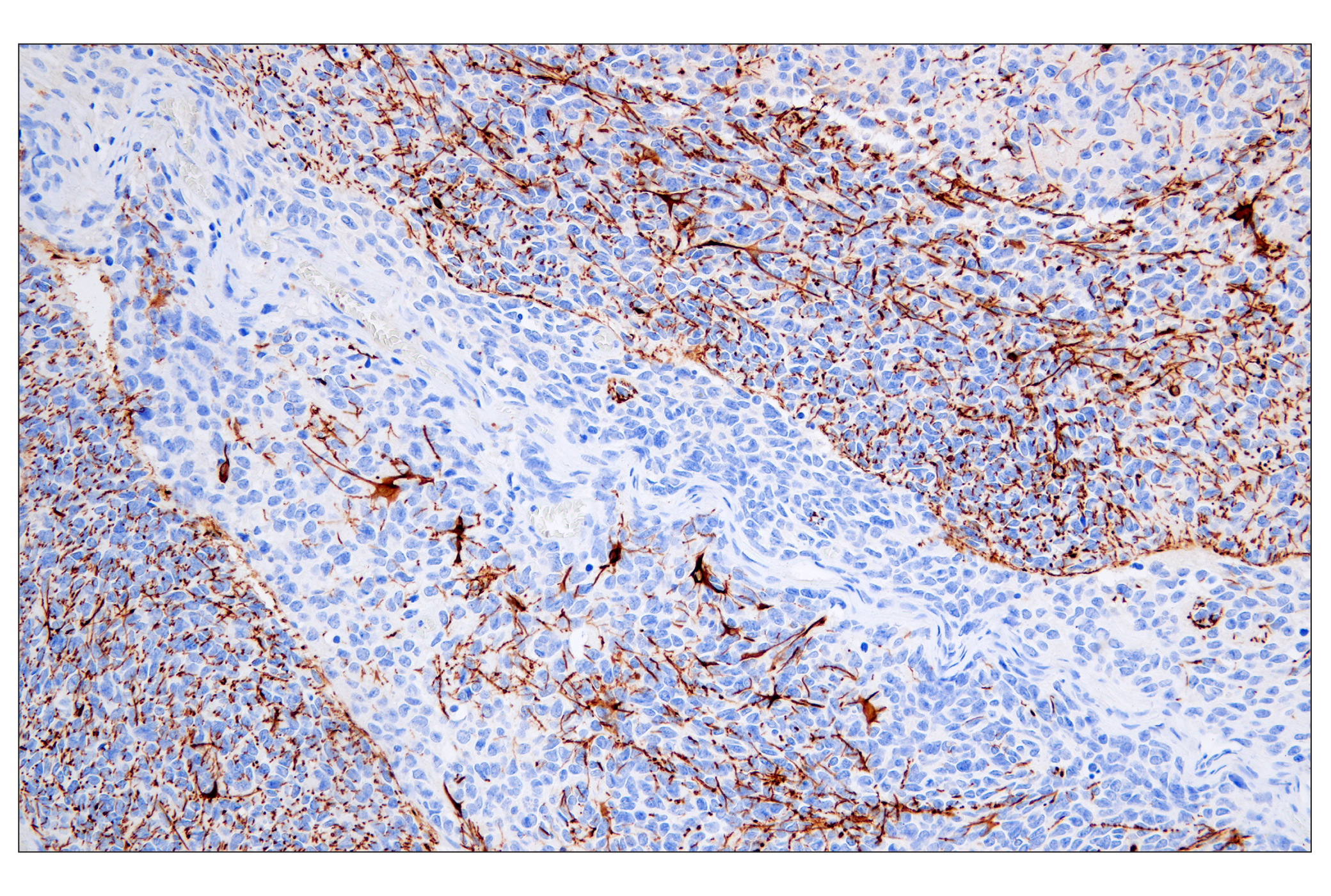 Immunohistochemistry Image 6: GFAP (E4L7M) XP® Rabbit mAb