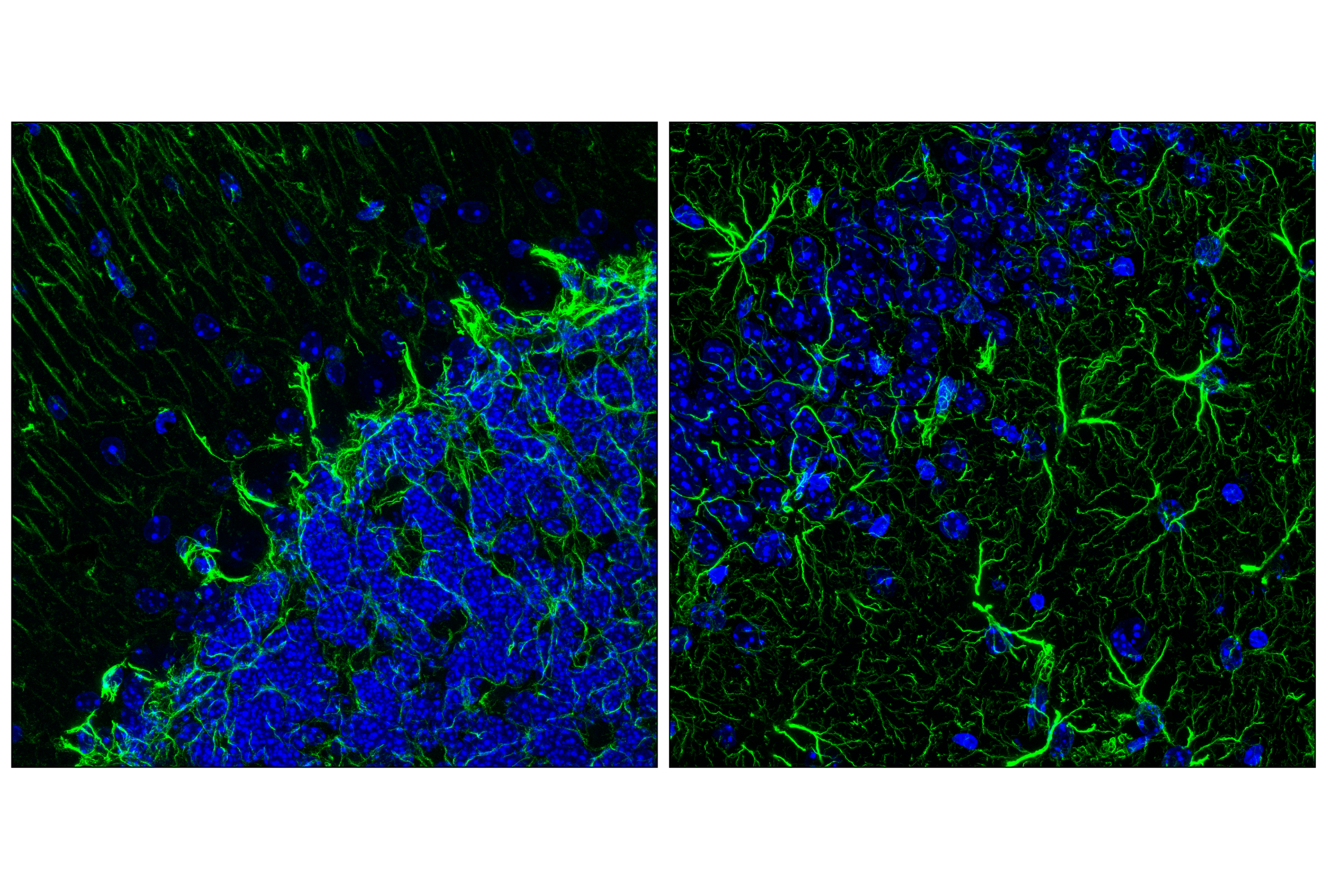  Image 44: Astrocyte Markers Antibody Sampler Kit