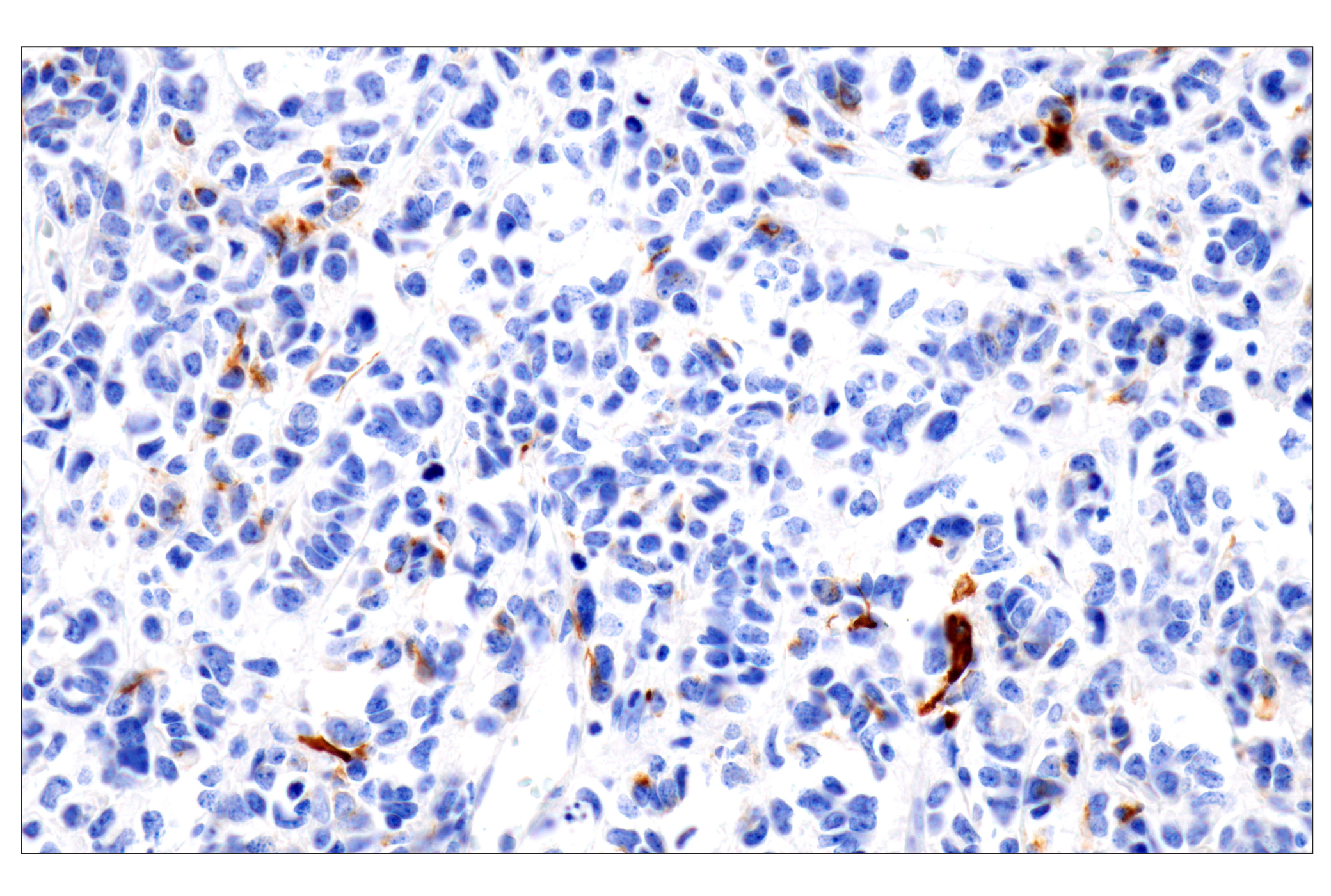 Immunohistochemistry Image 2: GFAP (E4L7M) XP® Rabbit mAb