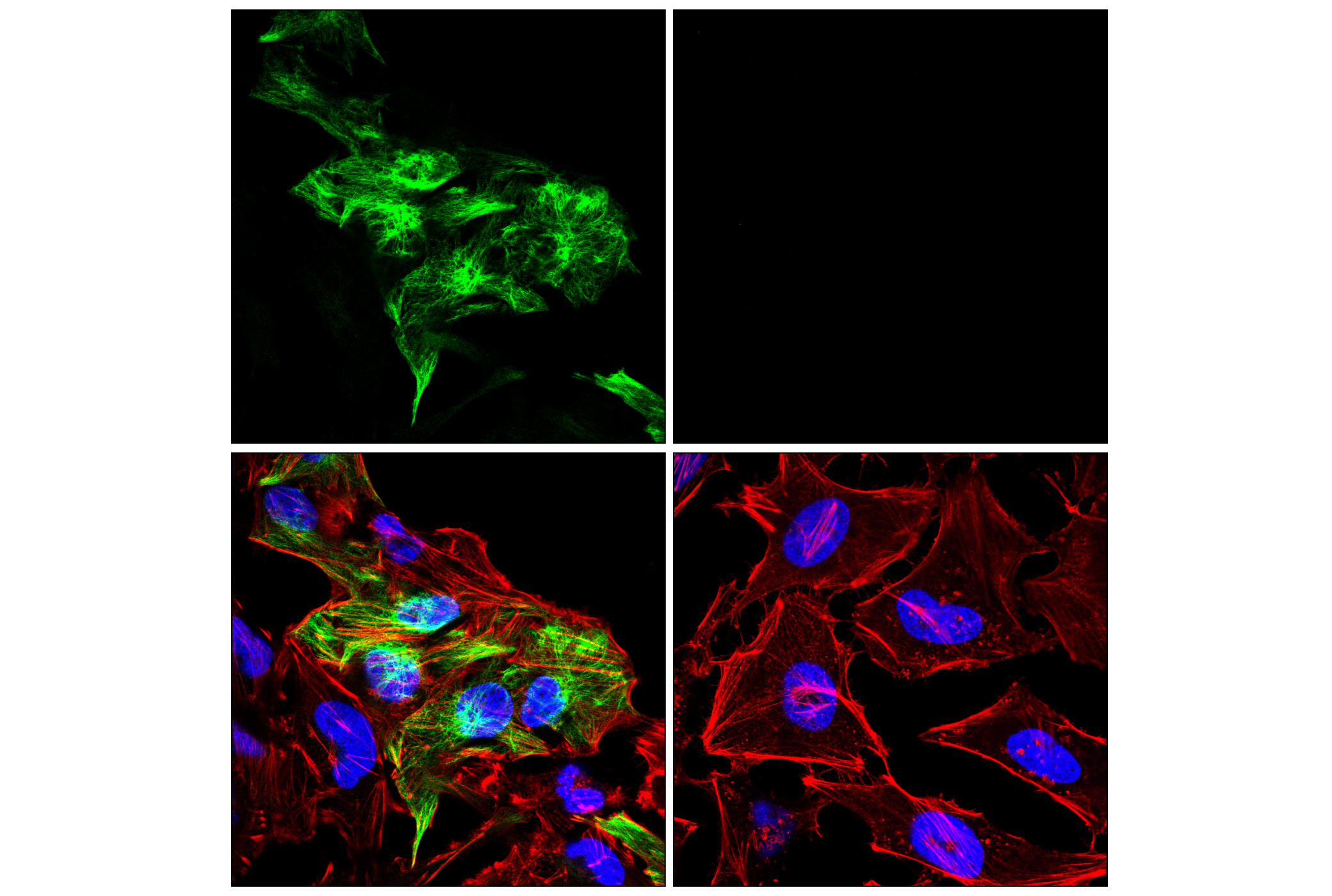  Image 4: Astrocyte Markers Antibody Sampler Kit