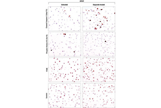 Immunohistochemistry Image 1: SignalStain® Proliferation/Apoptosis IHC Sampler Kit