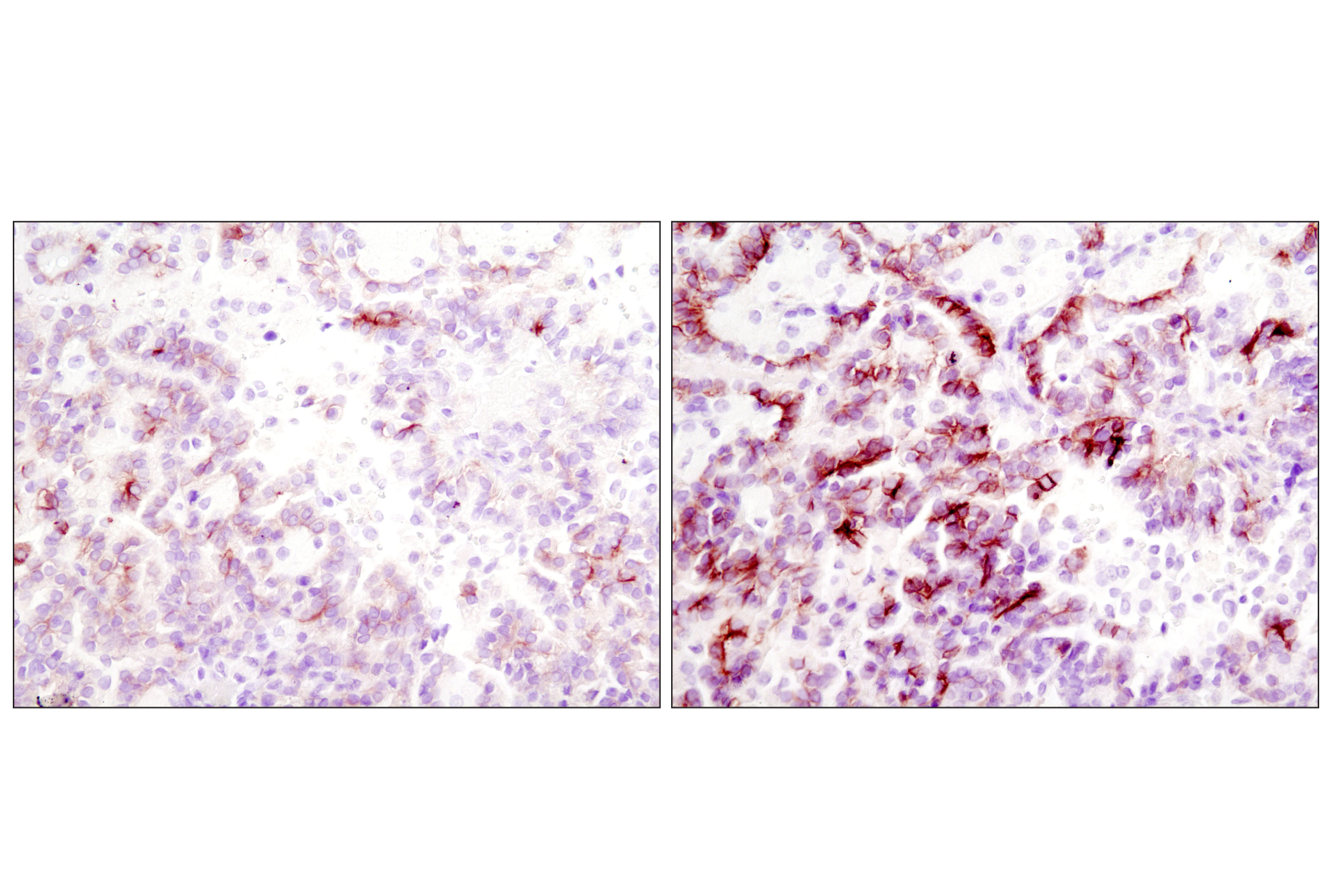 Immunohistochemistry Image 2: SignalStain® Boost IHC Detection Reagent (HRP, Rabbit)