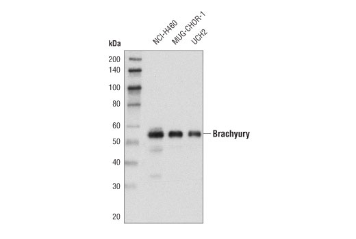 Western Blotting Image 1: Brachyury (D2Z3J) Rabbit mAb