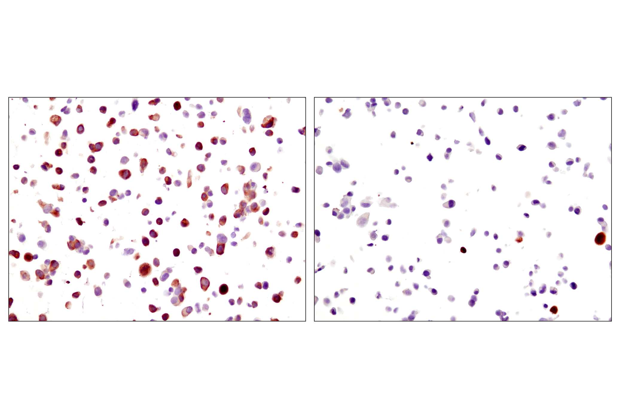 Immunohistochemistry Image 1: Phospho-S6 Ribosomal Protein (Ser235/236) (D57.2.2E) XP® Rabbit mAb (BSA and Azide Free)