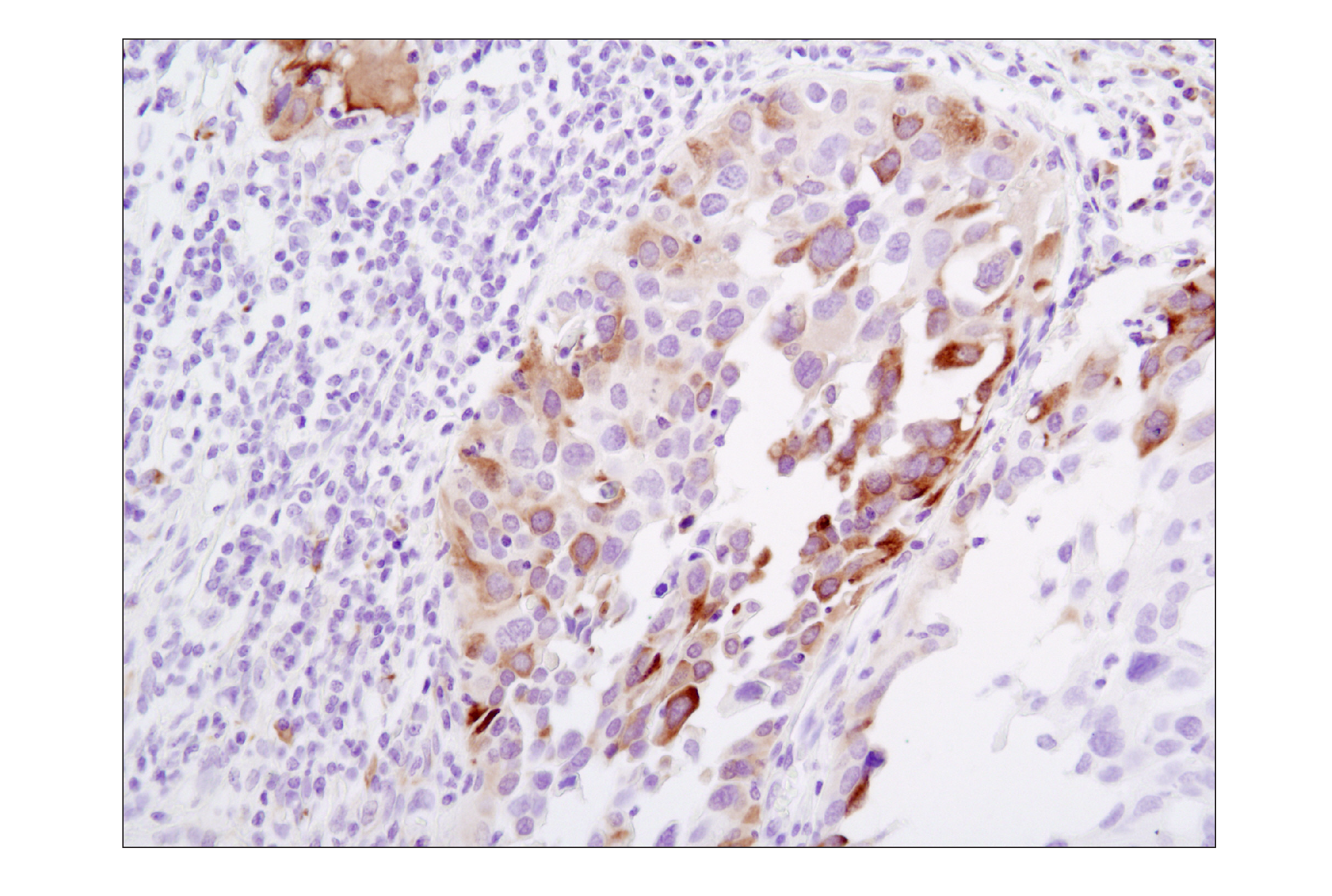 Immunohistochemistry Image 2: Phospho-S6 Ribosomal Protein (Ser235/236) (D57.2.2E) XP® Rabbit mAb (BSA and Azide Free)