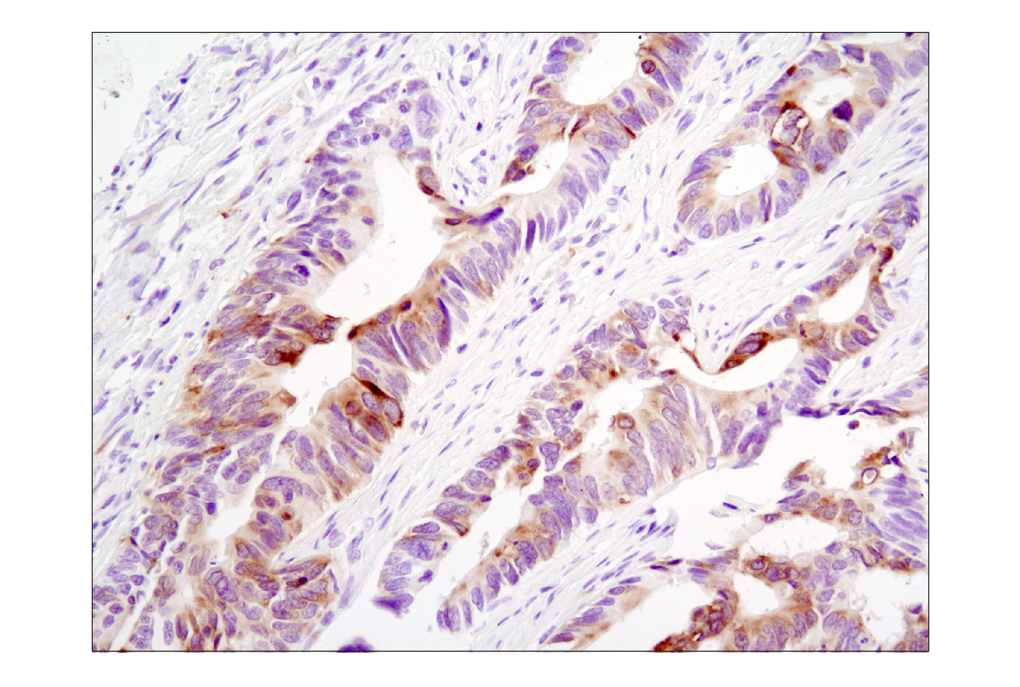 Immunohistochemistry Image 6: Phospho-S6 Ribosomal Protein (Ser235/236) (D57.2.2E) XP® Rabbit mAb (BSA and Azide Free)