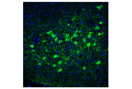 Immunofluorescence Image 1: p75NTR (D4B3) XP® Rabbit mAb