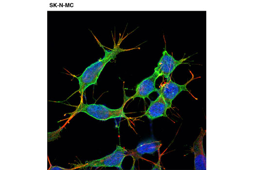 Immunofluorescence Image 3: p75NTR (D4B3) XP® Rabbit mAb