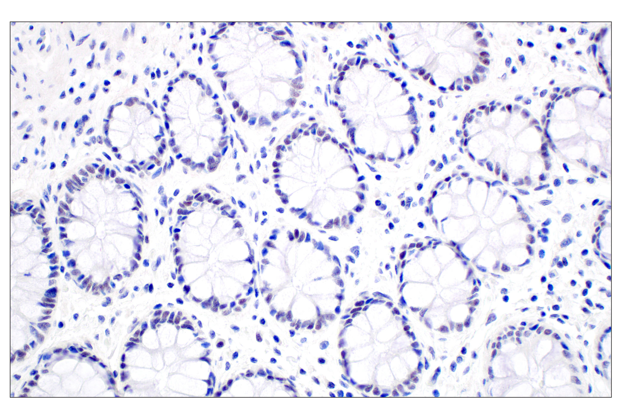 Immunohistochemistry Image 6: MDM2 (F7W7X) Rabbit mAb