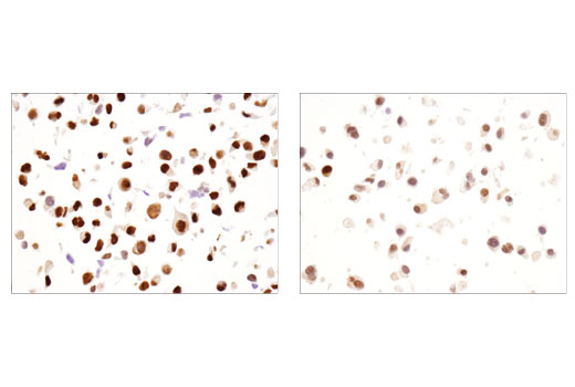 Immunohistochemistry Image 6: Sox9 (D8G8H) Rabbit mAb